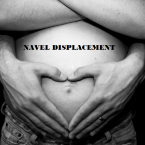 Program for Navel Displacement
